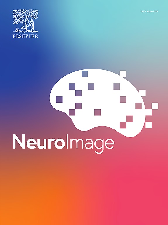 NeuroImage